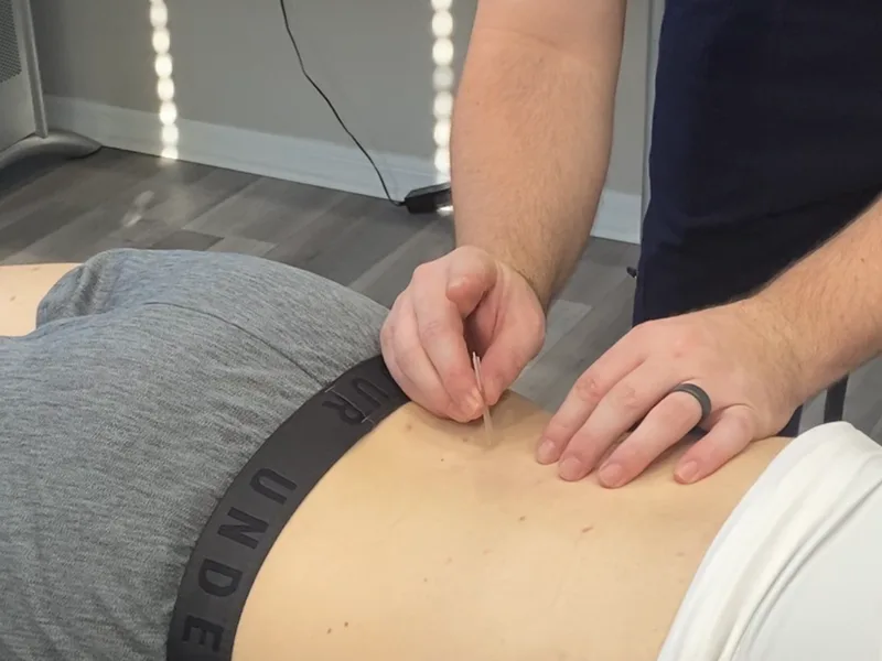 How Dry Needling works at Locke Chiropractic & Rehabilitation Center