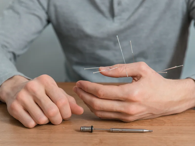 Dry Needling at Locke Chiropractic & Rehabilitation Center in Winston-Salem
